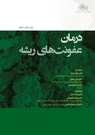 درمان عفونت های ریشه 2022